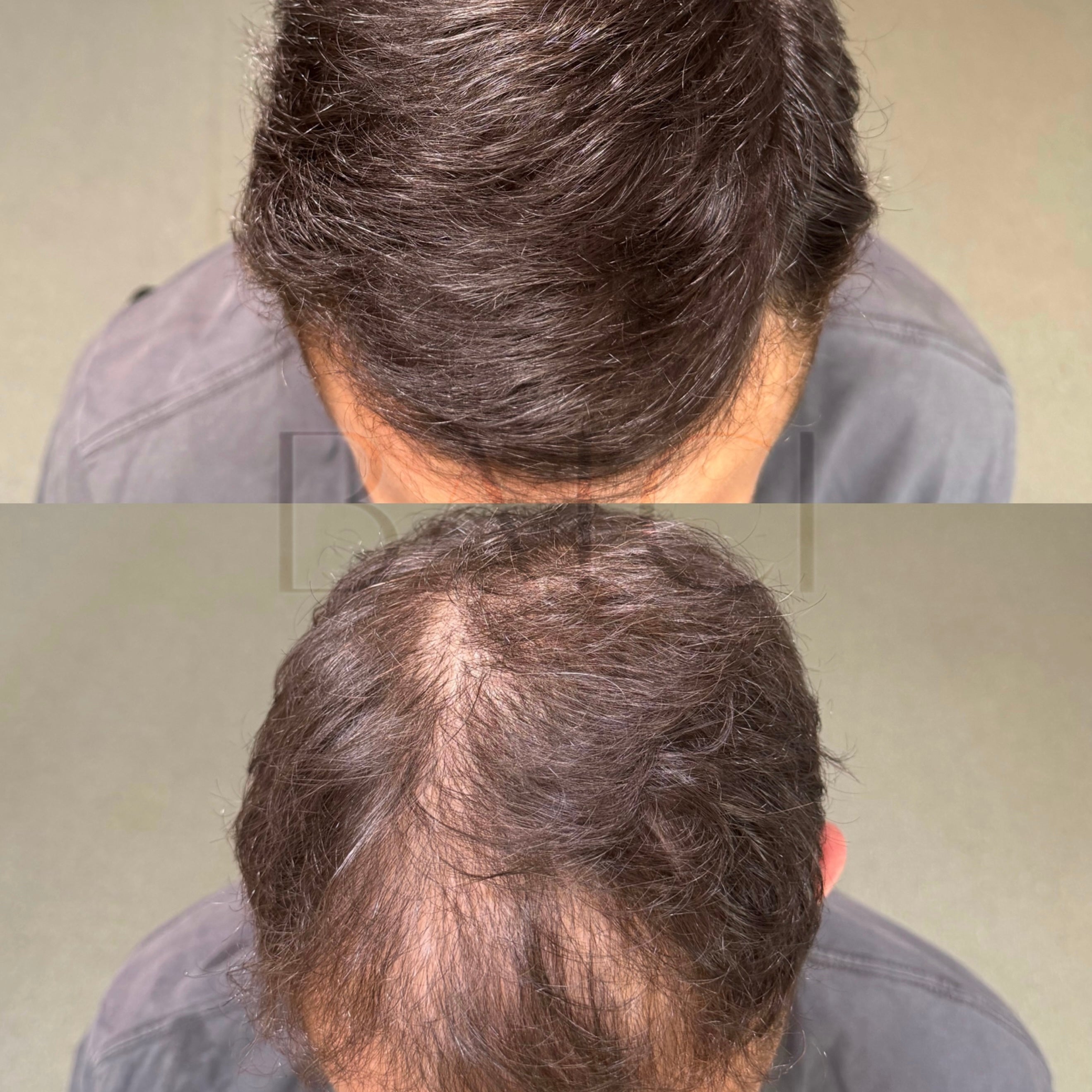 PACK CRÈME & SHAMPOING (+ 1 PEIGNE OFFERT)