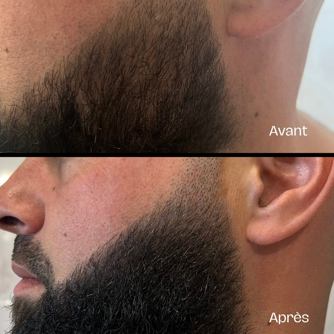 Crème de remplissage capillaire - 30 ml